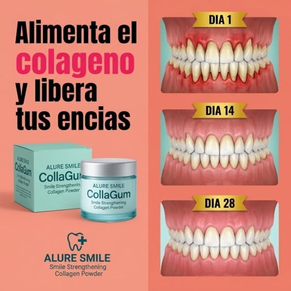 AlureSmile