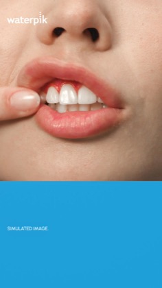 Waterpik Oral Health
